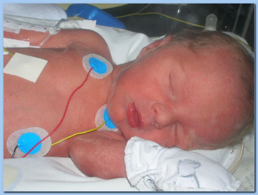 naissance corentin 068